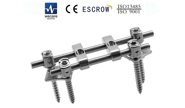 KSS-II5-5mm Anterior Fixation System